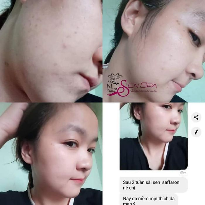 Sen Spa ảnh 1