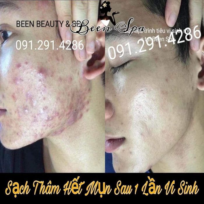 Been Spa ảnh 2