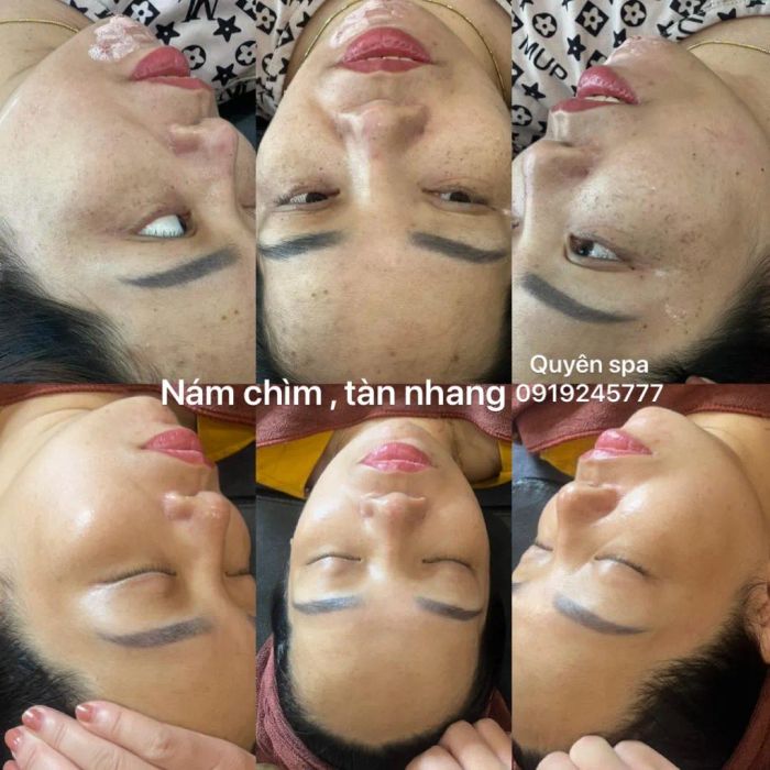 Quyên Spa - Hành trình khám phá vẻ đẹp rạng ngời qua từng hình ảnh ấn tượng.