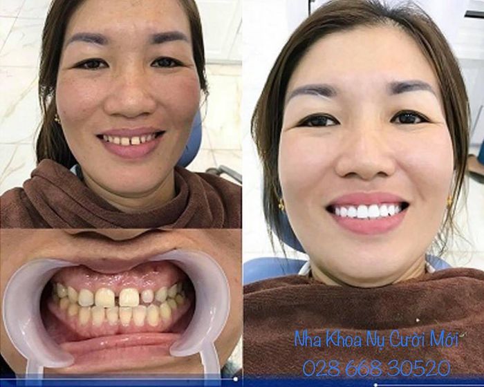 Hình ảnh cơ sở vật chất hiện đại tại Nha Khoa Nụ Cười Mới