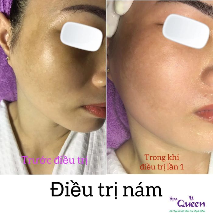 Queen Spa ảnh 2