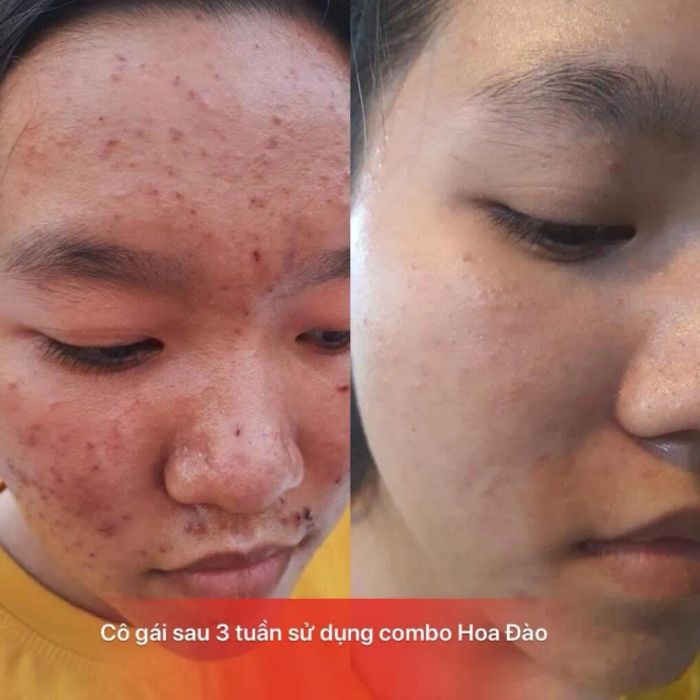 Hình ảnh Muội Spa 2