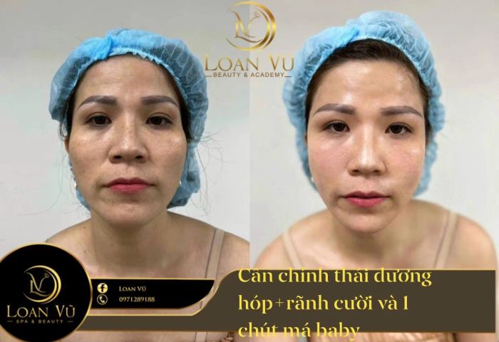 Loan Vũ Spa - Hành trình khám phá vẻ đẹp hoàn mỹ qua từng góc hình ấn tượng