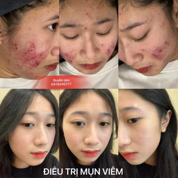 Quyên Spa - Khoảnh khắc đẹp nhất được lưu giữ qua góc nhìn nghệ thuật đầy tinh tế.