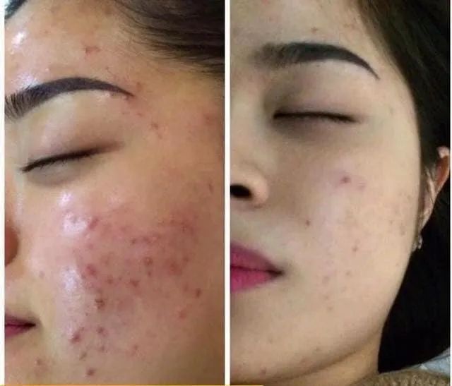 Hình ảnh Han Tran Beauty & Spa 1