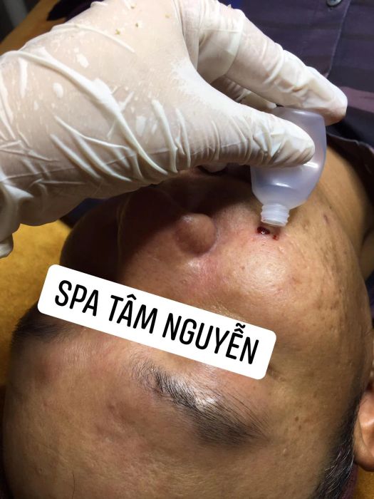 Khu vực điều trị chuyên nghiệp tại Tâm Nguyễn Spa