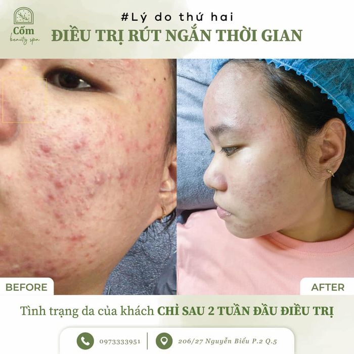 Cốm Beauty Spa ảnh 2