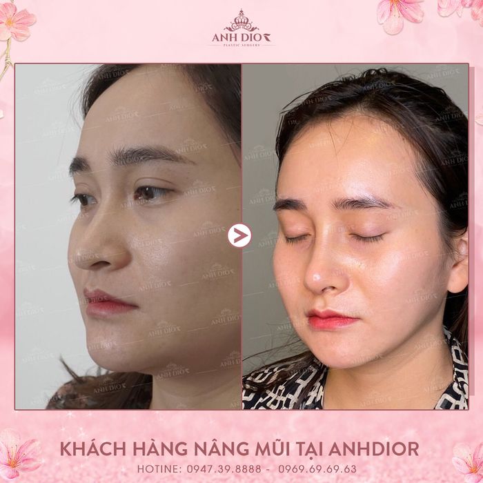 Ảnh minh họa của AnhDior Beauty
