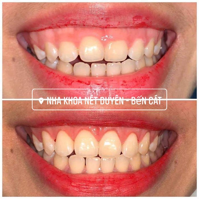 Hình ảnh đội ngũ bác sĩ chuyên nghiệp tại Nha Khoa Nét Duyên