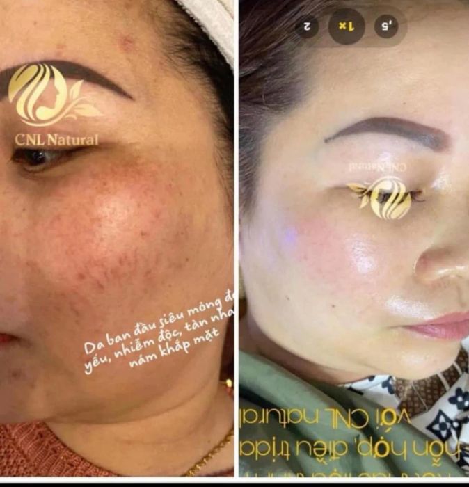 Linh Spa - Hành trình khám phá vẻ đẹp hoàn mỹ qua từng khoảnh khắc
