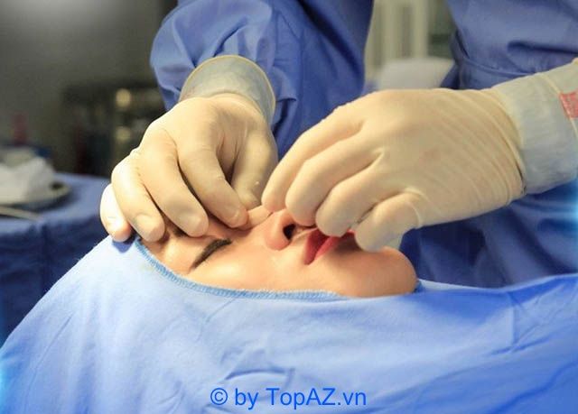 Sửa mũi hỏng ở đâu tại TP.HCM?