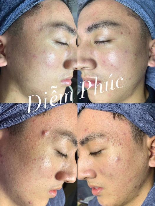 Ảnh Diễm Phúc Beauty & Spa 2