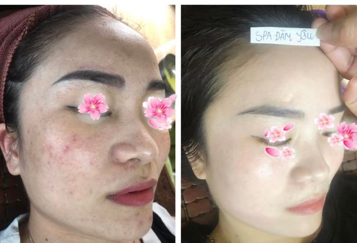 Ảnh Đàm Yêu Spa 2