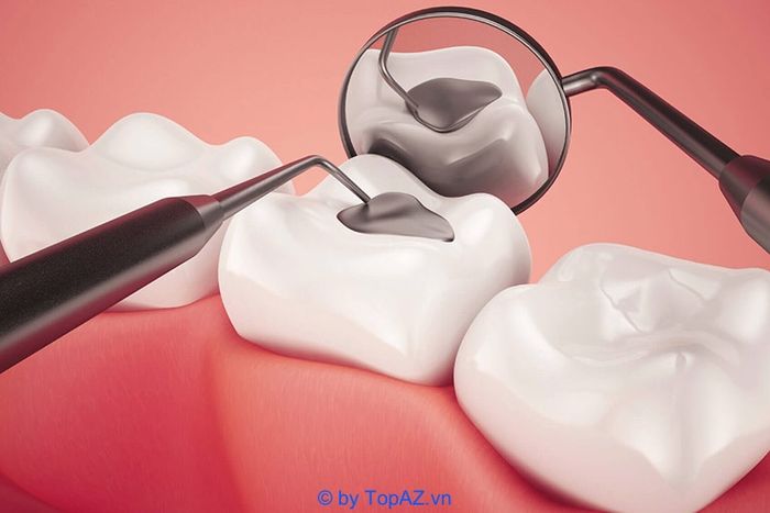 địa chỉ trám răng đẹp tại hà nội