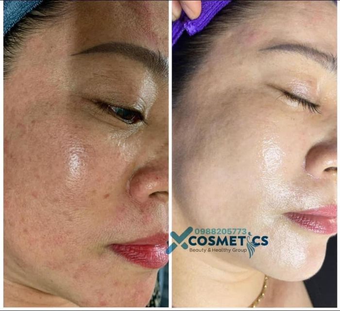 Ảnh Diễm Phúc Beauty & Spa 1