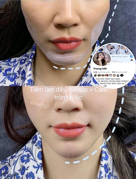 Ảnh Trang Mit Beauty Spa 1