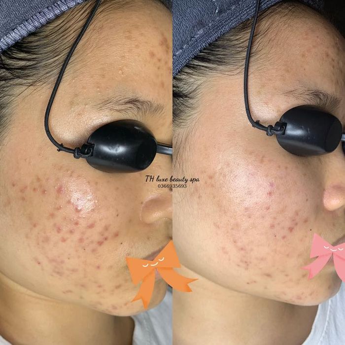 Ảnh TH Luxe Beauty Spa 2