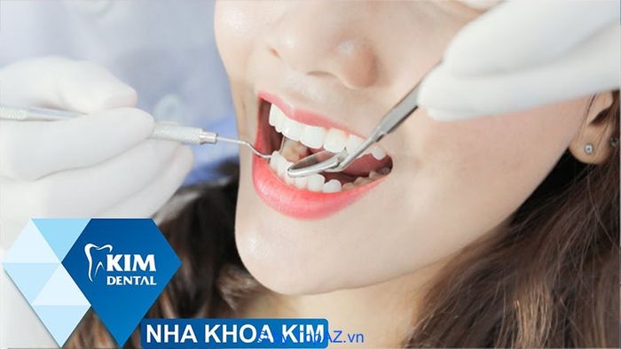 địa chỉ trám răng thẩm mỹ uy tín tại Hà Nội