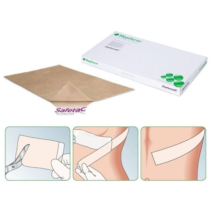 Miếng dán trị sẹo Mepiform ảnh 1