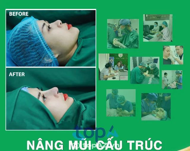 Khoa Phẫu thuật Tạo hình - Thẩm mỹ Bệnh viện Chấn thương Chỉnh hình Nghệ An