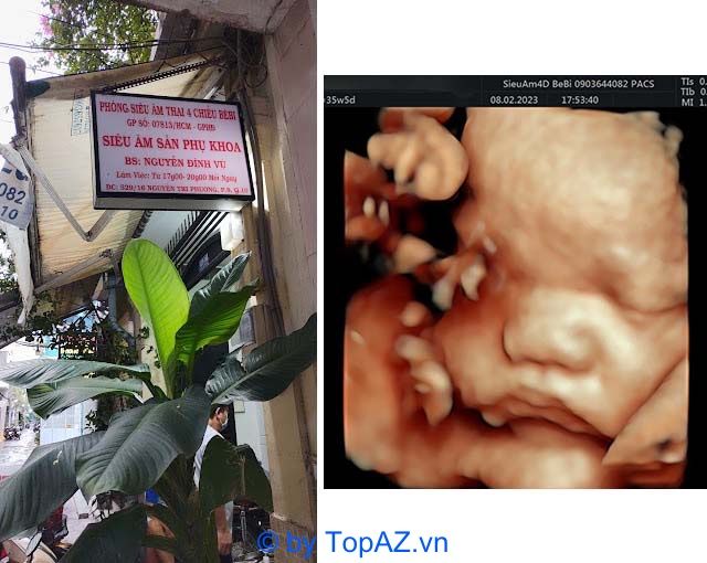 Phòng khám siêu âm 5D uy tín tại TPHCM