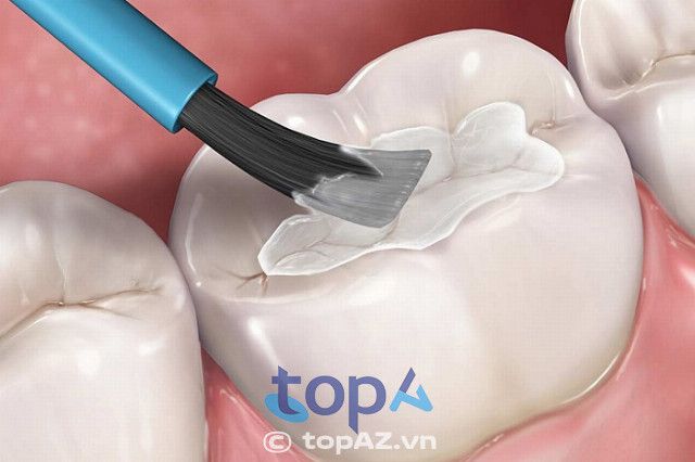 Nha Khoa Đinh Gia - Địa chỉ vàng cho nụ cười tỏa sáng tại Đà Lạt