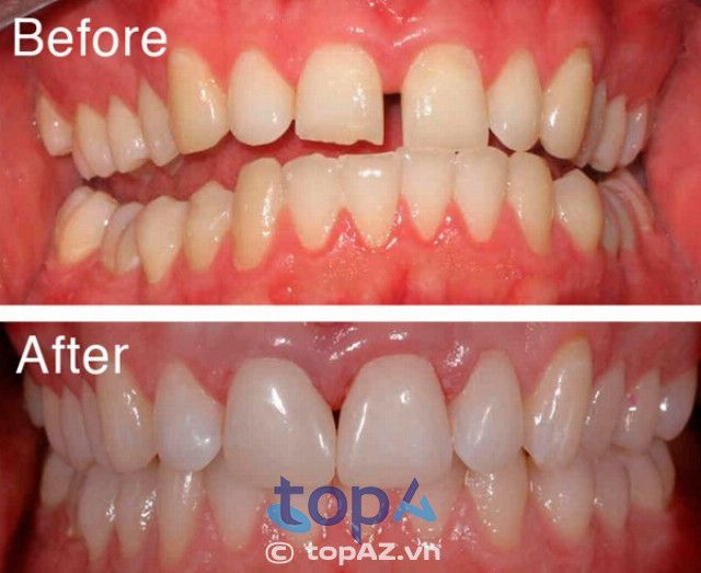 Nha khoa Tâm Sài Gòn - Điểm sáng nha khoa giữa lòng Đà Lạt