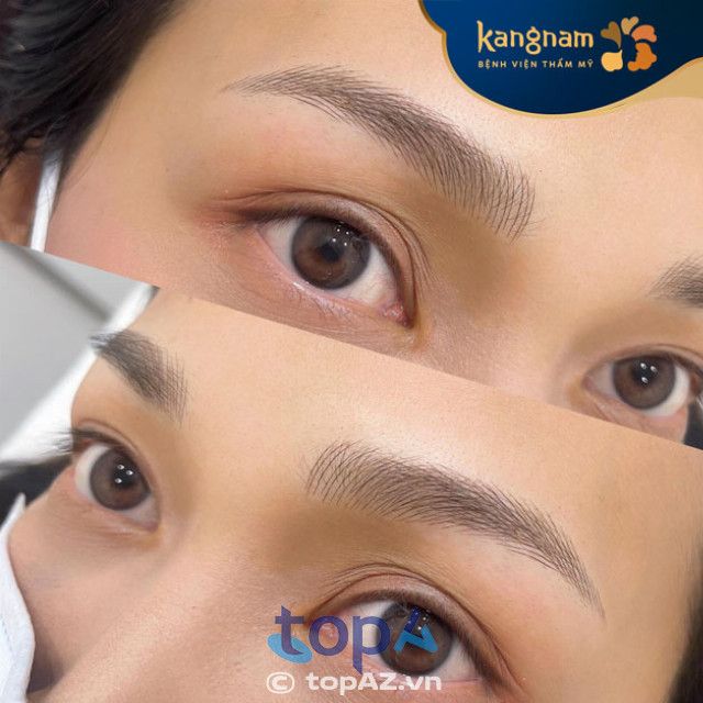 Viện Thẩm Mỹ Kangnam - Điểm đến làm đẹp chuẩn Hàn tại Cần Thơ