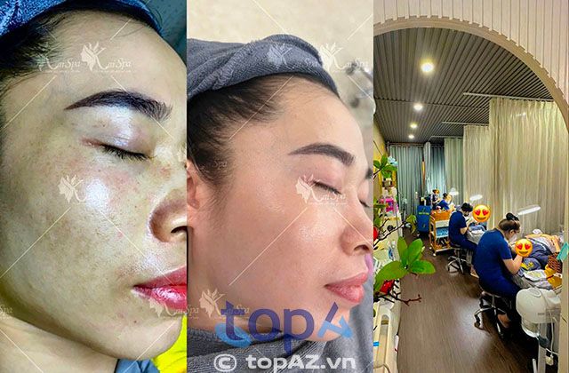 Kai Spa – Spa uy tín tại Quận 6, Hậu Giang, là lựa chọn lý tưởng để bạn cải thiện vẻ đẹp và sự tự tin của mình.