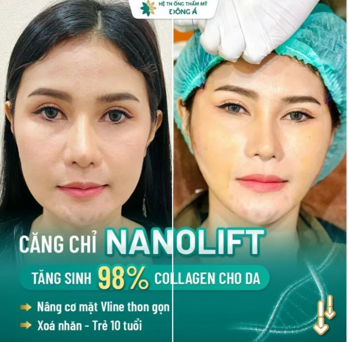 Hình ảnh thực tế quy trình điều trị tại Đông Á Đà Nẵng