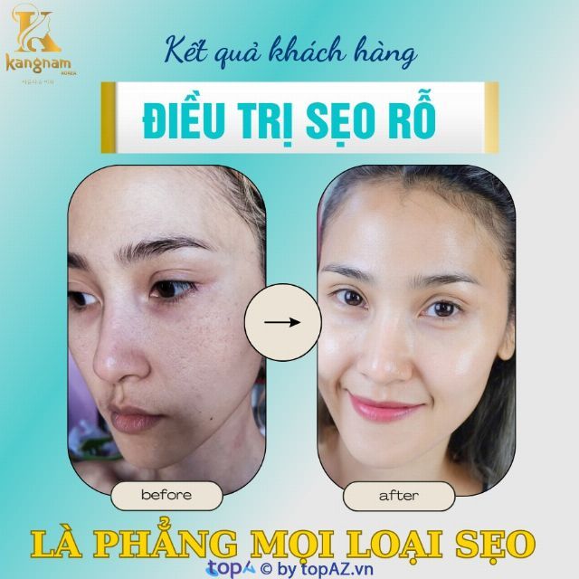 Viện Thẩm Mỹ Kangnam Korea Gia Lai - Đồng hành cùng vẻ đẹp của bạn