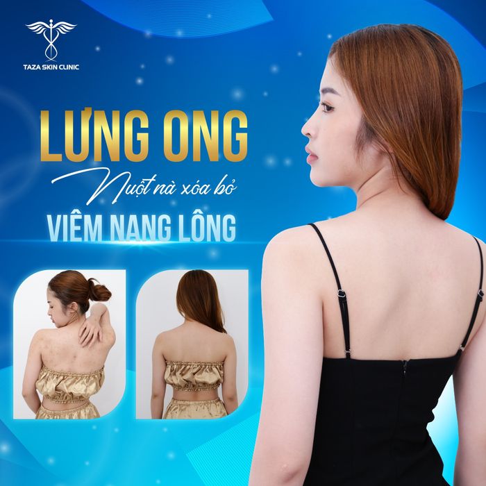 Taza Skin Clinic ảnh 2