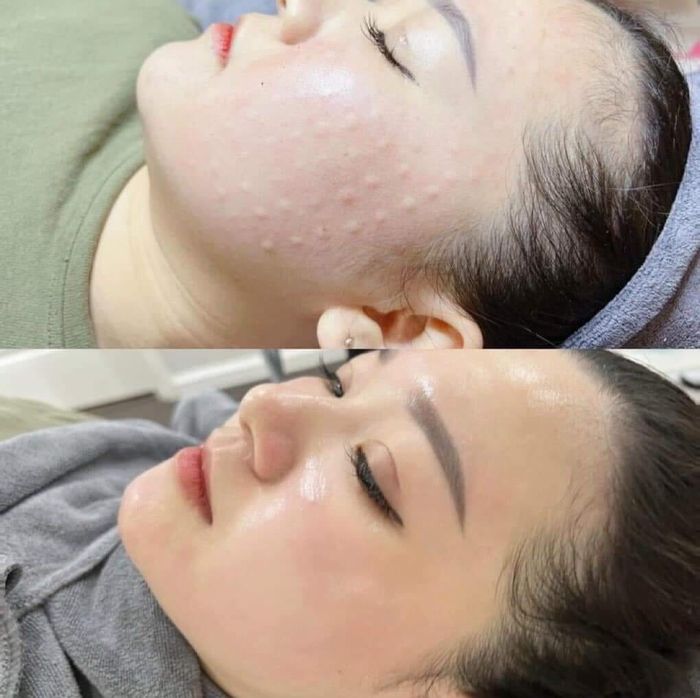 Hình ảnh Thẩm Mỹ Viện HaNa Beauty Hà Nội 1