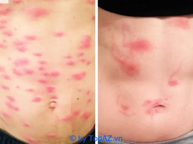 Xét nghiệm ký sinh trùng tại TPHCM với công nghệ cao
