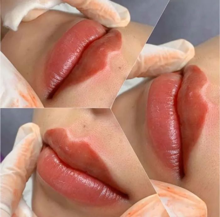 Hình ảnh thực tế tại Hoàng Việt Mai Beauty