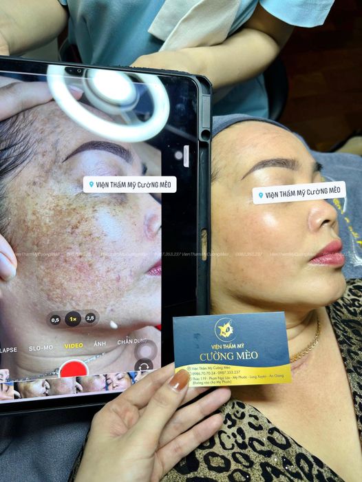 Viện Thẩm Mỹ Cường Mèo - ảnh 2