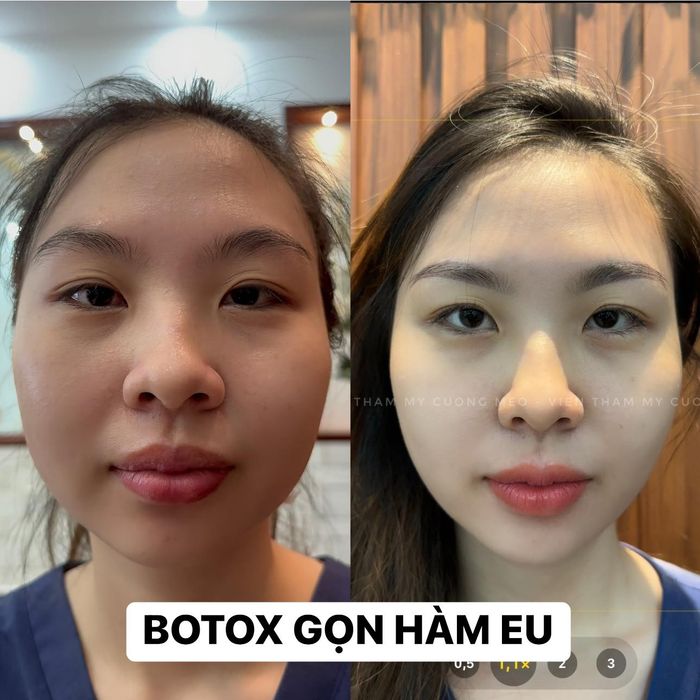 Viện Thẩm Mỹ Cường Mèo - ảnh 1