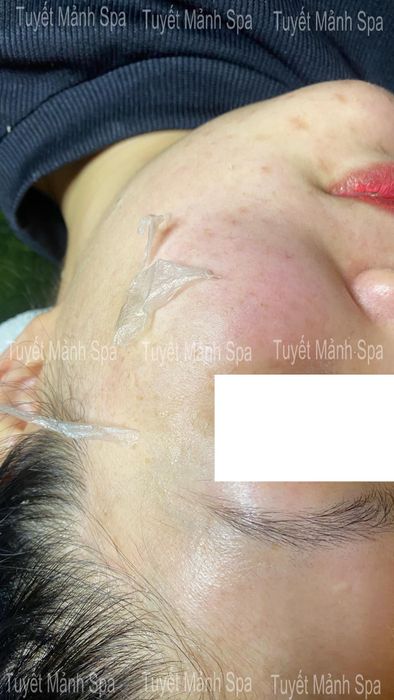 Tuyết Mảnh spa hình ảnh 2