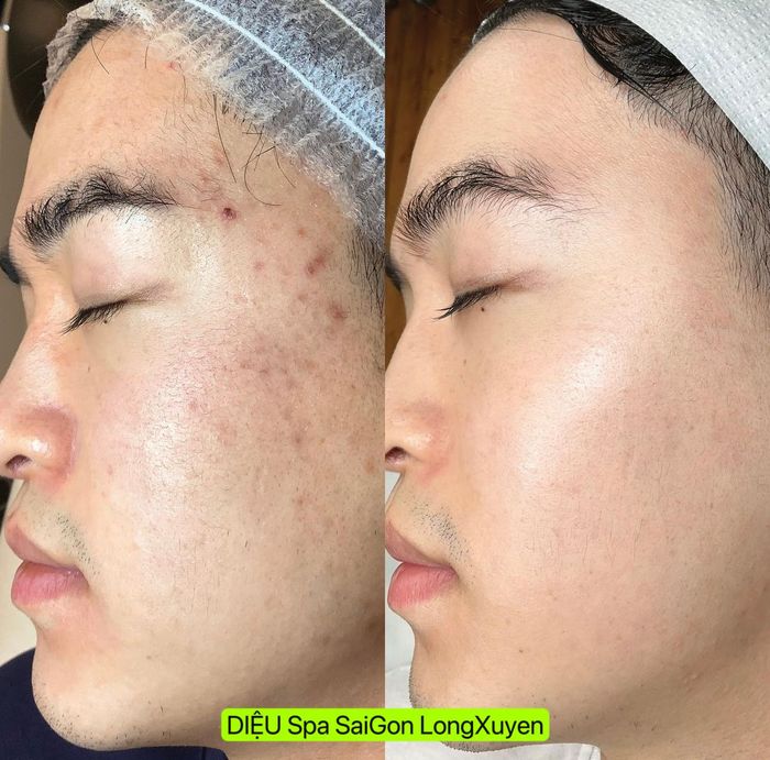 Diệu Spa Long Xuyên - ảnh 2