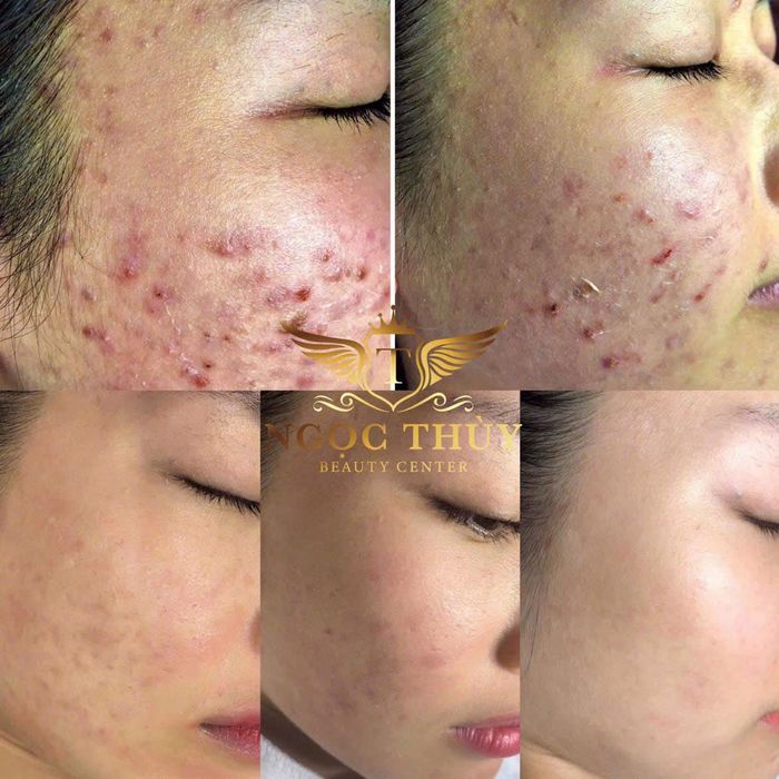 Ngọc Thuỳ Spa - ảnh 1