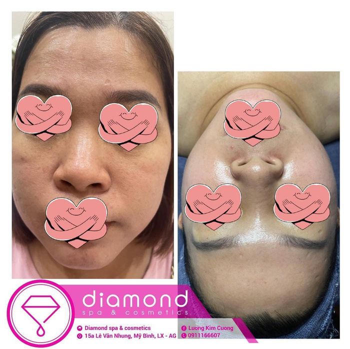 Diamond Spa & Cosmetics - ảnh 1