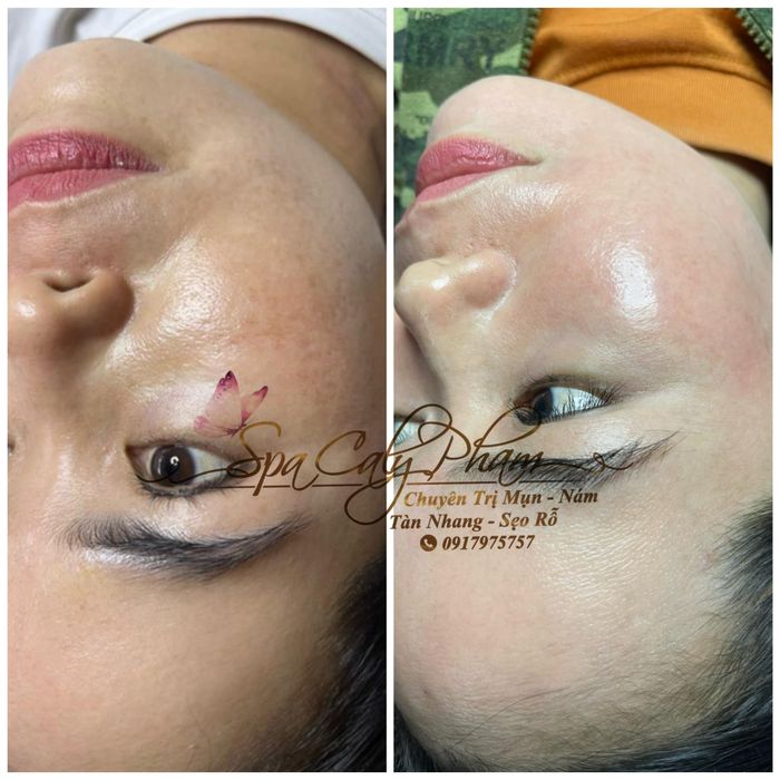 Spa Caly Phạm hình ảnh 1