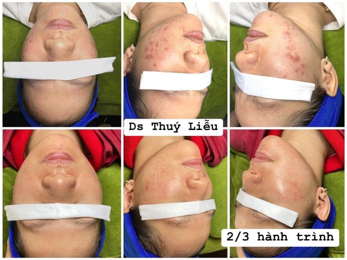 Phòng điều trị da công nghệ cao tại Liuu Beauty Spa & Clinic