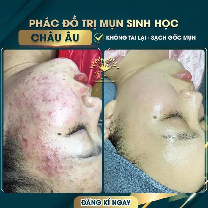 Góc làm đẹp tiêu chuẩn 5 sao tại Kim Spa Tây Ninh