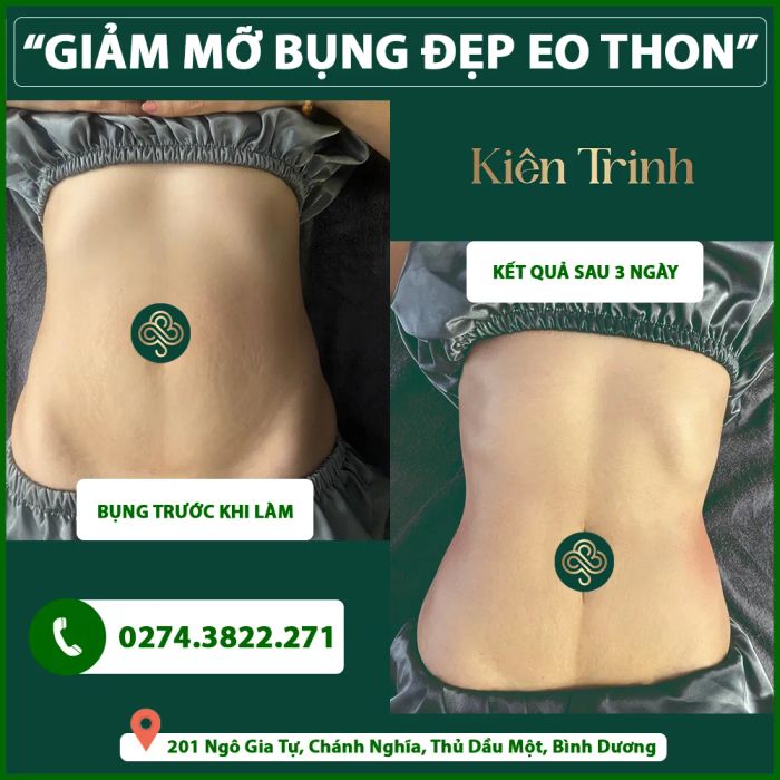 Kiên Trinh Beauty Spa tại Bình Dương - Ảnh 1