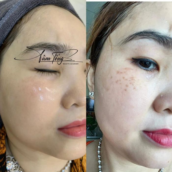 Khu vực trị liệu cao cấp tại TÂM TỐNG SPA