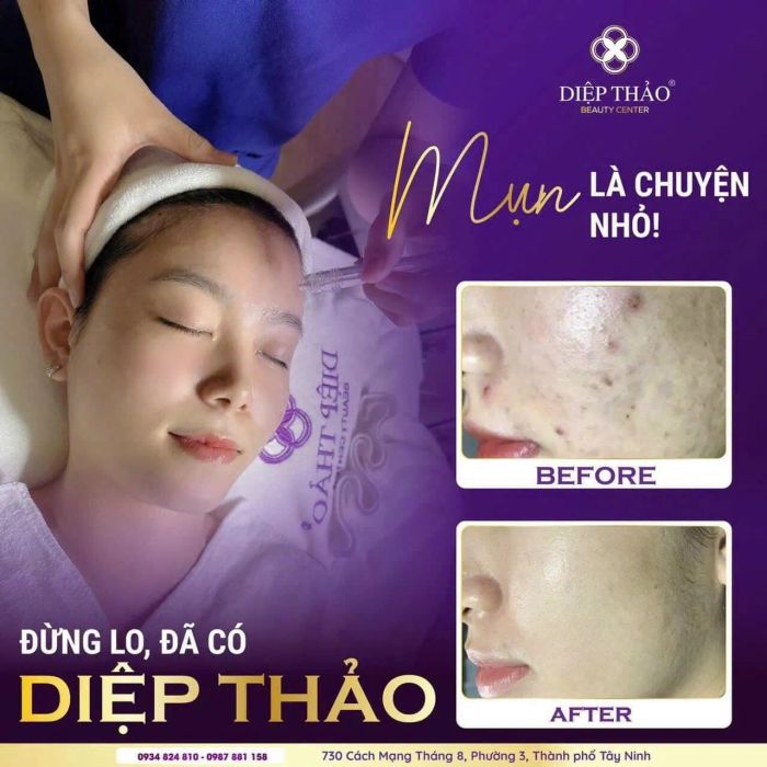 Không gian trị liệu đẳng cấp tại DIỆP THẢO MEDI-SPA