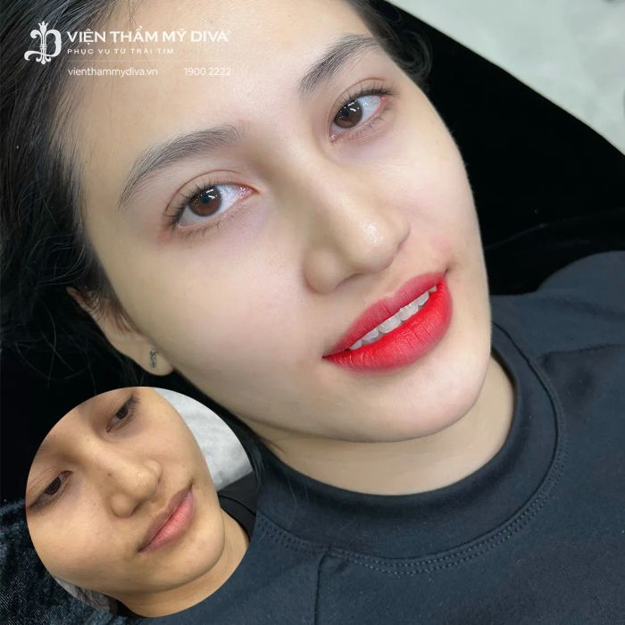 Viện Thẩm Mỹ DIVA - Ảnh 2