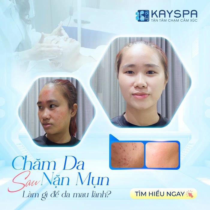 Không gian trị liệu cao cấp tại KAY SPA Tây Ninh