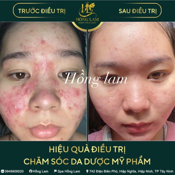 Góc làm đẹp tiêu chuẩn tại Spa Hồng Lam